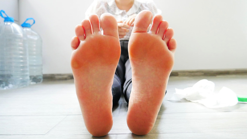 7 Serious Foot Problems