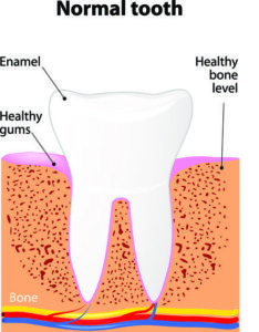7 Types of Dental and Oral Diseases and Treatments